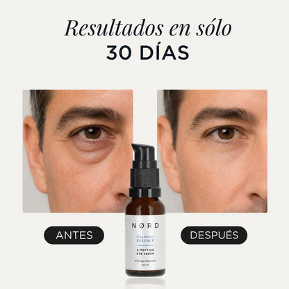 Serum Anti-edad